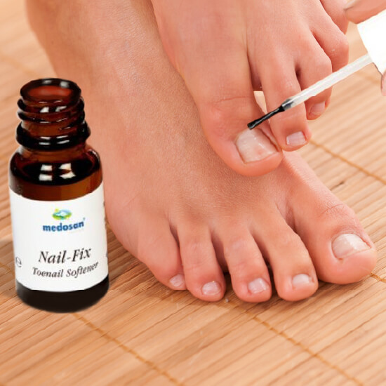 NFIX, Medosan Nail Fix